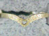 Click to see more information about this 'Toe Rings' item.